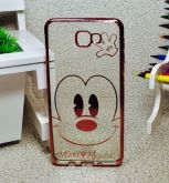 Case Mickey Face Luxo Rose Galaxy J7 Prime