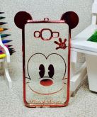 Case Luxo Mickey Orelha Rose Galaxy J7 J700