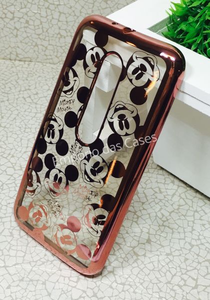 Case Luxo Mickey Rose Moto G3