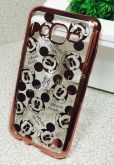 Case Luxo Mickey Rose Galaxy J7 J700