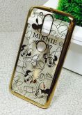 Case Luxo Minnie Dourado Moto G4 / G4 Plus