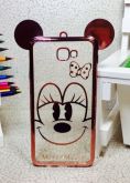 Case Luxo Minnie Orelha Rose Galaxy J7 Prime